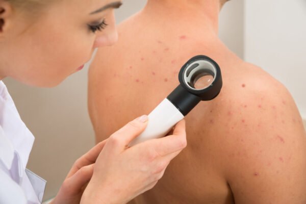 Dermatology Cases for GPs: A Practical Guide for IMGs